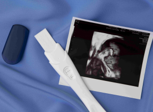 В Тульской области часть клиник отказалась делать аборты